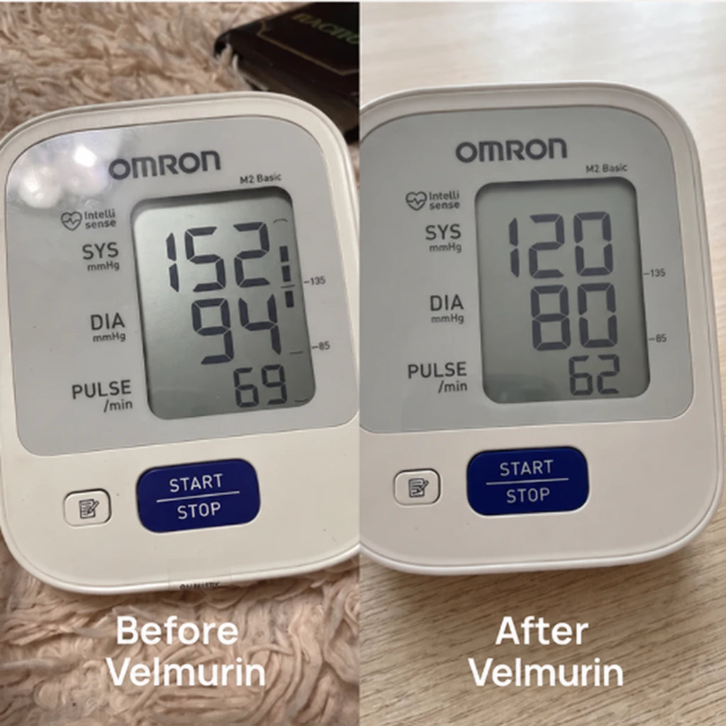 Before and after
